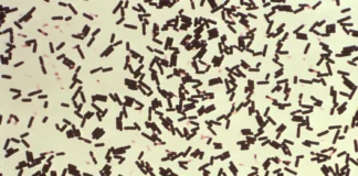 Probiotici - prirodna zaštita od bolesti