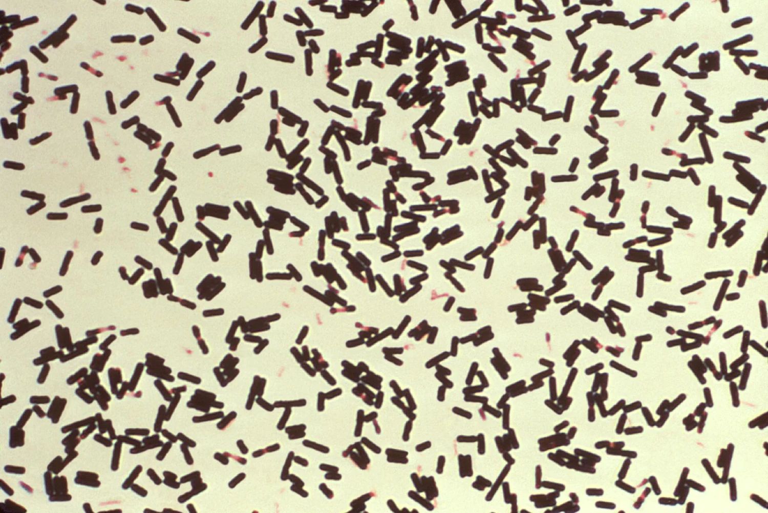 Probiotici - prirodna zaštita od bolesti